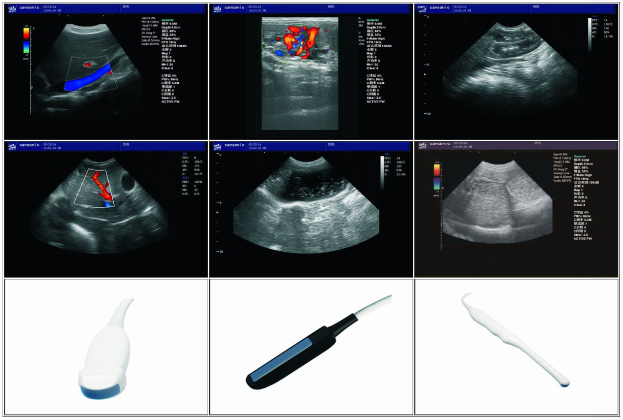 Veterinary Color Doppler Ultrasound Scanner (K2VET)1